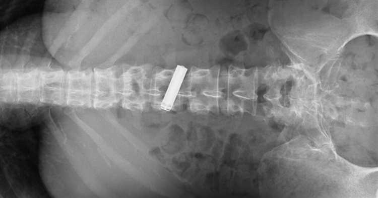 Опасность для детей: что произойдет, если ребенок проглотит батарейку?