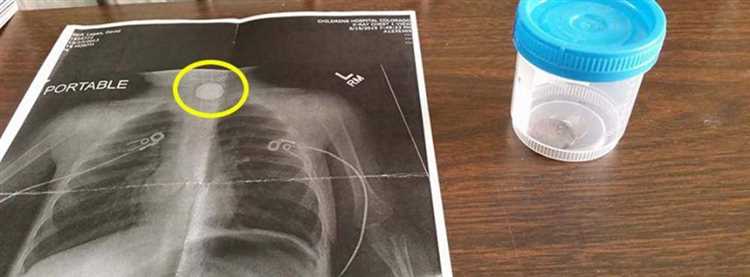 Электротравмы