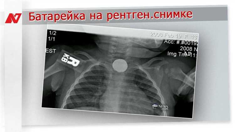 1. Химический ожог